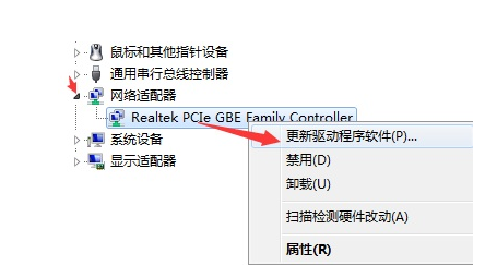 本地连接不见了