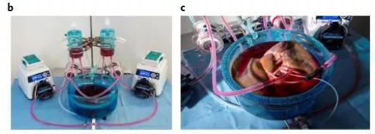 ▲机器灌注系统和亚低温机器灌注期间的肝脏（图片来源：参考资料[1]）