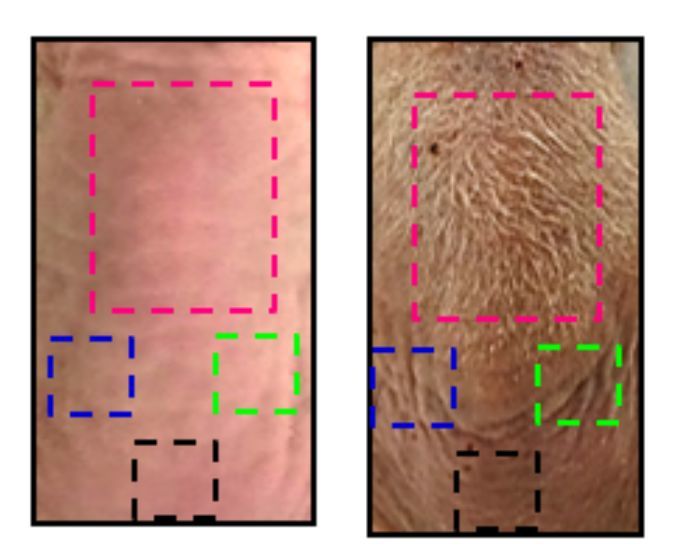 粉色框为用贴片处理的大鼠皮肤，其余均为对照。 图片来自： University of Wisconsin–Madison