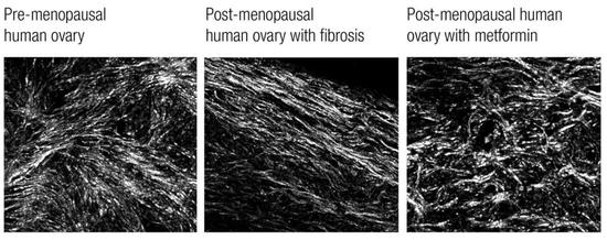 第一张和第三张图相近，说明在纤维化程度上，服用二甲双胍女性的卵巢，还保持着绝经前“年轻”的状态（图片来源：渥太华大学）