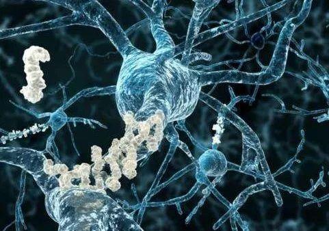 老年痴呆症有救了？首款阿尔茨海默病新药明年初申请上市