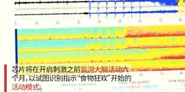 他们在大脑中植入芯片，只是为了减肥