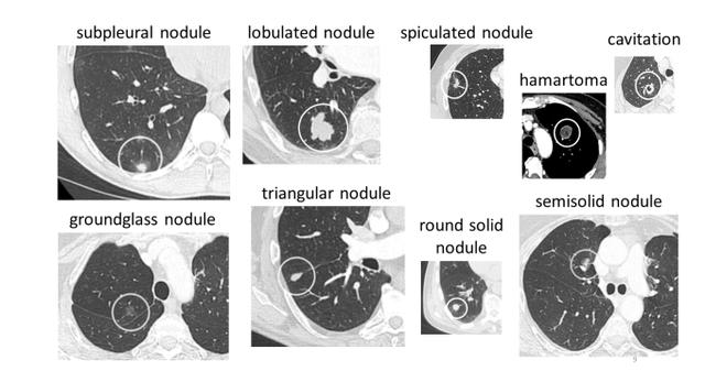 拍CT不再需要等医生诊断！AI自动出结果，放射科无人化迈出一大步