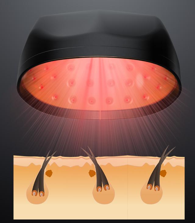 小米有品众筹激光生发帽，带上很帅气，12周长出新头发！