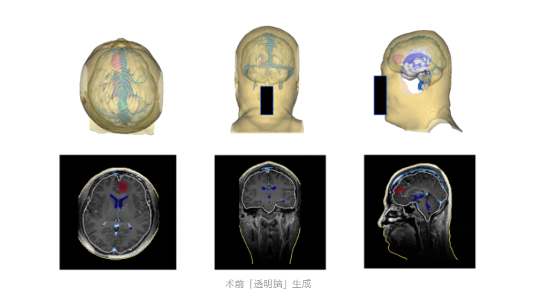 图片 2